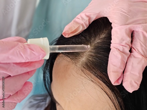 Woman applies a drop of oil from a pipette to her scalp, close-up concept