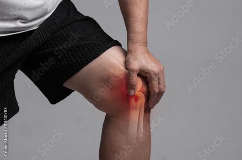 X-ray of knee,woman in her 70s holding her knee with a red pain point. Knee paint and joint pain concept photo