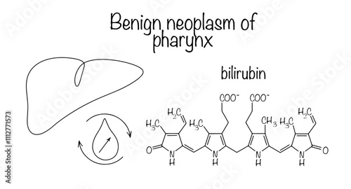 Benign hyperbilirubinemia