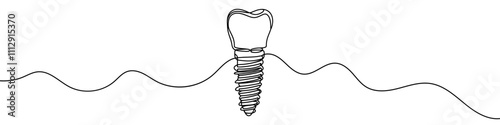 One continuous line illustration of dental implant, isolated on white background. Line art of dental implant