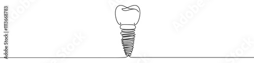 One continuous line illustration of dental implant, isolated on white background. Line art of dental implant