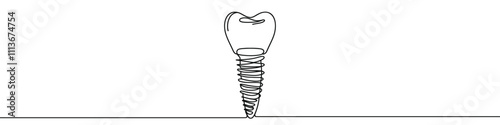 One continuous line illustration of dental implant, isolated on white background. Line art of dental implant
