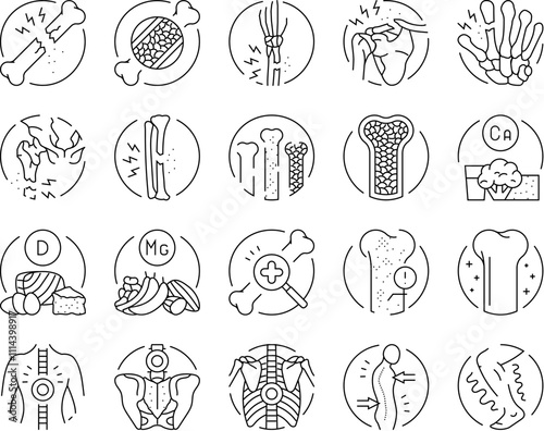 osteoporosis bone pain calcium icons set vector. health anatomy, spine doctor, knee woman, arthritis density, hip femur, structure osteoporosis bone pain calcium black contour illustrations