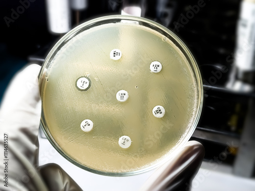 Carta da parati Antimicrobial susceptibility testing in petri dish