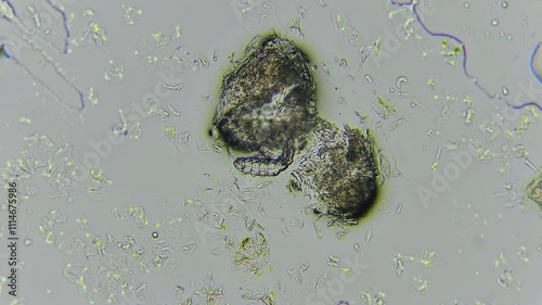 Demodex on dog's skin video taken with microscope under big magnification	