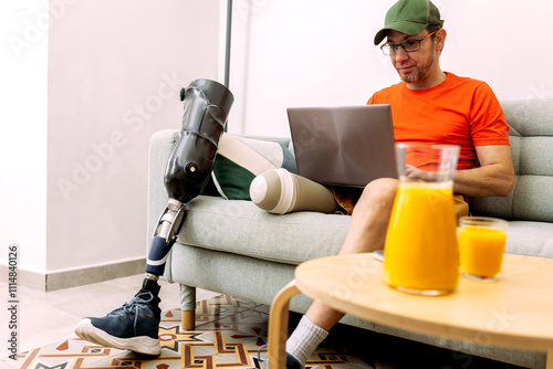 Man with Prosthetic Leg Working on Laptop in Living Room photo