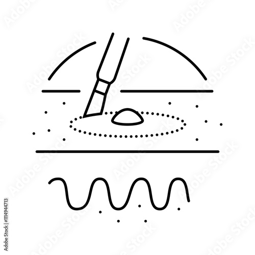 dilation and curettage surgery line icon vector. dilation and curettage surgery sign. isolated contour symbol black illustration