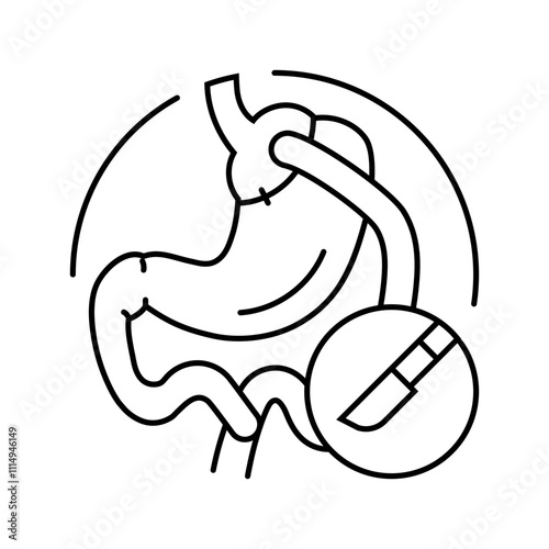 gastric bypass surgery line icon vector. gastric bypass surgery sign. isolated contour symbol black illustration