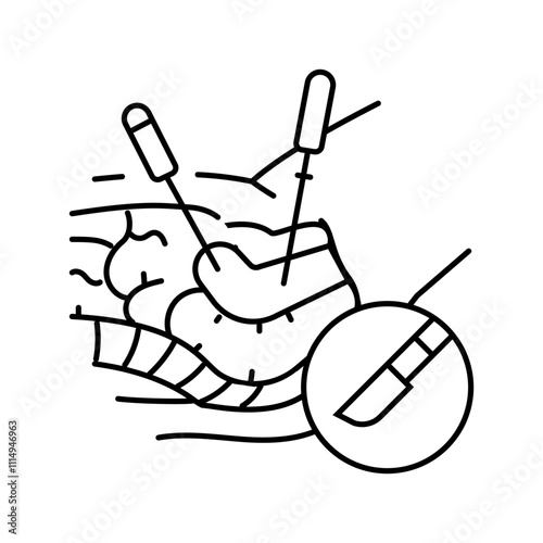 gynecologic laparoscopy line icon vector. gynecologic laparoscopy sign. isolated contour symbol black illustration