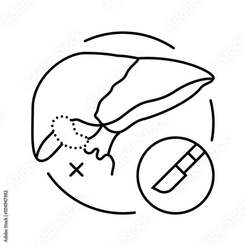cholecystectomy surgery line icon vector. cholecystectomy surgery sign. isolated contour symbol black illustration