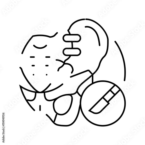 joint fusion surgery line icon vector. joint fusion surgery sign. isolated contour symbol black illustration