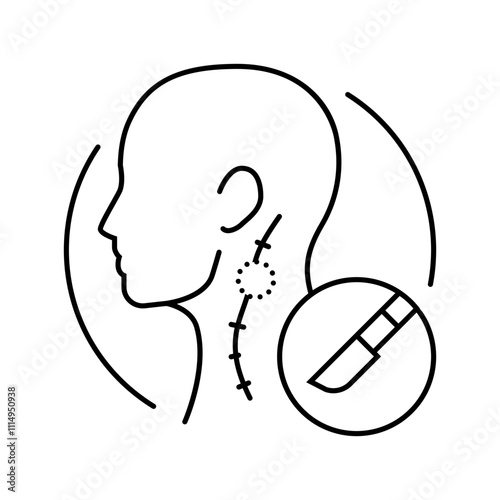 lymph node dissection surgery line icon vector. lymph node dissection surgery sign. isolated contour symbol black illustration