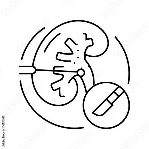 kidney transplant surgery line icon vector. kidney transplant surgery sign. isolated contour symbol black illustration