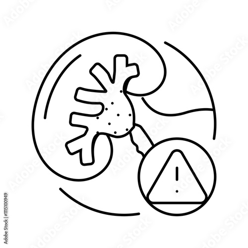 renal failure urology line icon vector. renal failure urology sign. isolated contour symbol black illustration