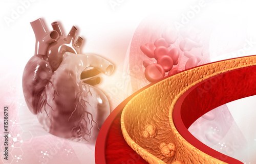 Wallpaper Mural Cholesterol blocked artery with human heart. 3d illustration.. Torontodigital.ca