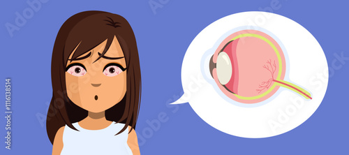 Woman with red eyes suffering fatigue vector illustration. Cross section eye having redness problem