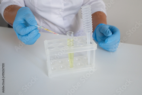 Urinalysis or urine test with express strips photo