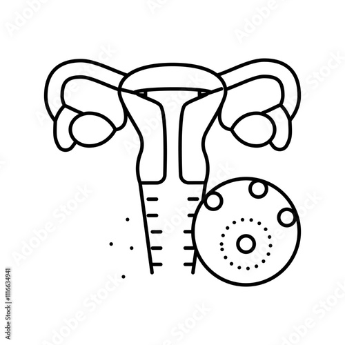 vaginal infections woman disease line icon vector. vaginal infections woman disease sign. isolated contour symbol black illustration