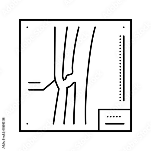 x ray of fracture line icon vector. x ray of fracture sign. isolated contour symbol black illustration