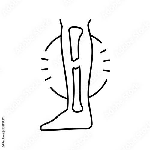 broken leg fracture injury line icon vector. broken leg fracture injury sign. isolated contour symbol black illustration