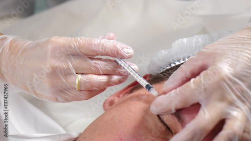 Beautician wearing latex gloves injects male patient forehead, targeting skin rejuvenation and wrinkle reduction for a more youthful look. Modern beauty clinic. antiage treatment. Closeup shot
