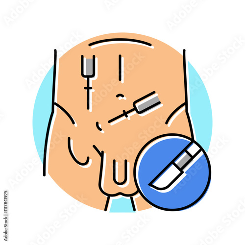 excisional biopsy surgery color icon vector. excisional biopsy surgery sign. isolated symbol illustration