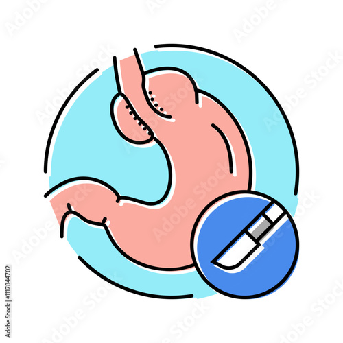 fundoplication surgery color icon vector. fundoplication surgery sign. isolated symbol illustration