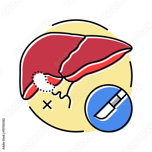 cholecystectomy surgery color icon vector. cholecystectomy surgery sign. isolated symbol illustration