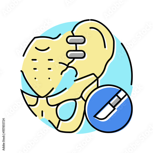 joint fusion surgery color icon vector. joint fusion surgery sign. isolated symbol illustration