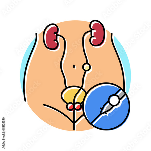 ureteroscopy urology color icon vector. ureteroscopy urology sign. isolated symbol illustration