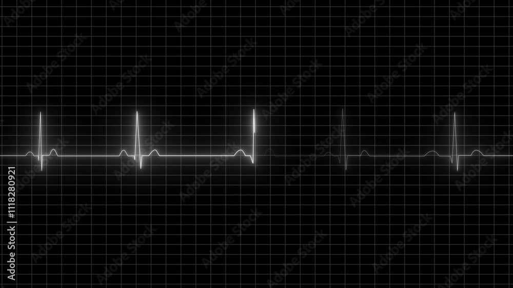 Abstract heartbeat and pulse rate signal technology animation on grid background. Heart beat pulse. Glowing neon blue heart cardiogram line on dark background. Electrocardiogram show heart beat line. 