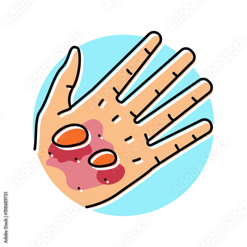 epidermolysis bullosa disease color icon vector. epidermolysis bullosa disease sign. isolated symbol illustration photo