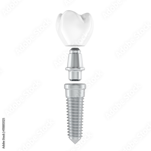 Dental implant. Screw, abutment and crown. 3D rendering isolated on transparent background