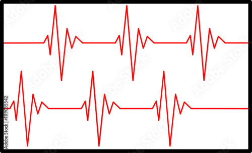 heart bit rate monitoring on white background, medical check heart with EKG, ECG tools measurement. result medical lab