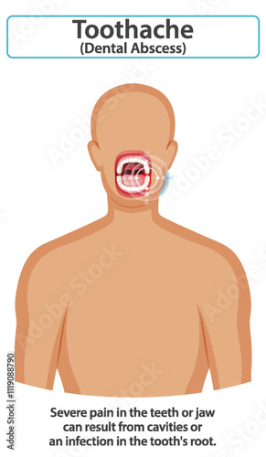 Understanding Toothache and Dental Abscess