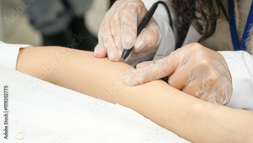 Professional woman performing needle epilation photo