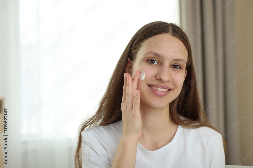 Teenage girl applying cream onto face at home, space for text. Acne treatment Teenage girl applying cream onto face at home, space for text. Acne treatment