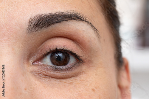 Woman showing crow's feet and dark circles under eye with makeup