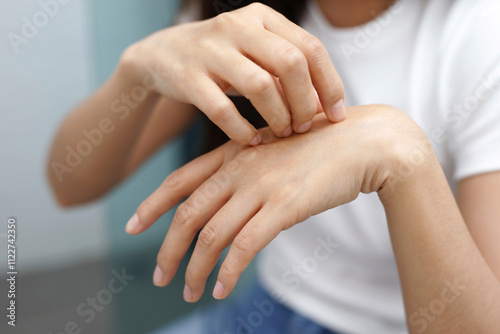 Wallpaper Mural Health problems, woman has itchy hands Torontodigital.ca