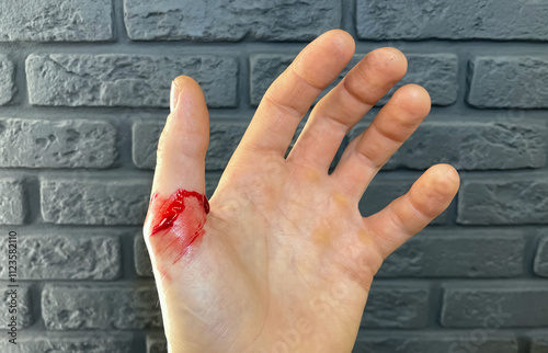 Bleeding wound on the thumb finger of the left hand. The man was injured by negligence at work. A man's hand with a cut, bleeding wound in close-up. Violation of safety regulations. A cut finger.