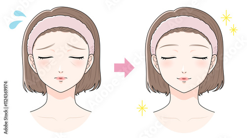 たるみに悩む前髪を上げた女性　ビフォーアフター　美容/肌トラブル
