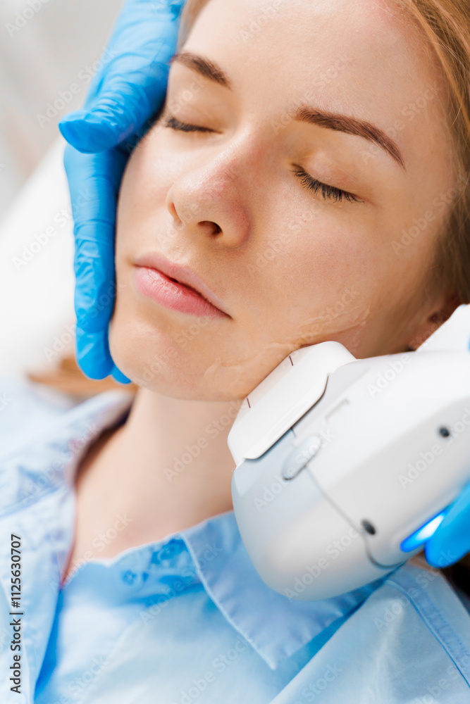 IPL laser rosacea and acne treatment, IPL laser pigmentation treatment in the cosmetology clinic. Ultrasound laser facial skincare procedure by beautician. IPL laser technology. IPL laser rosacea and acne treatment, IPL laser pigmentation treatment in the cosmetology clinic. Ultrasound laser facial skincare procedure by beautician. IPL laser technology.