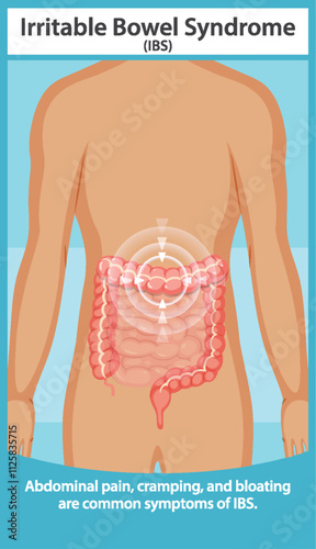 Understanding Irritable Bowel Syndrome