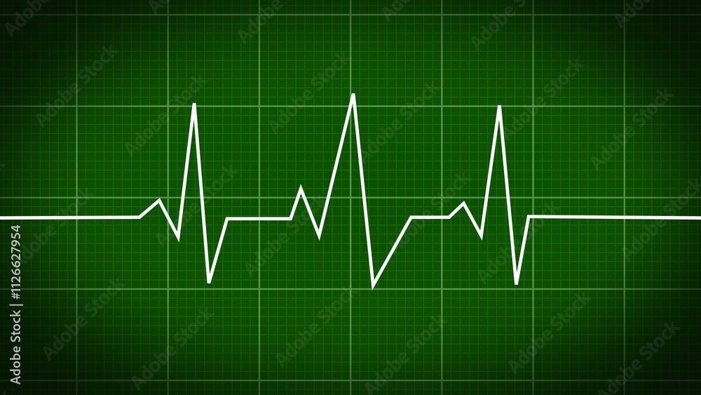 Naklejka premium heart beat on monitor