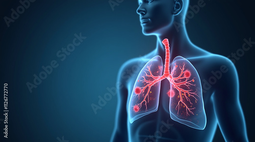 Human Lungs Infected with Bacteria, Lung Infection and Disease, Pneumonia  photo