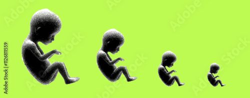 A minimalist vector illustration showing the progressive growth stages of a fetus in four silhouettes, displayed from largest to smallest, against a bright lime-green background.