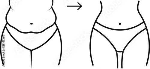 weight loss before and after 