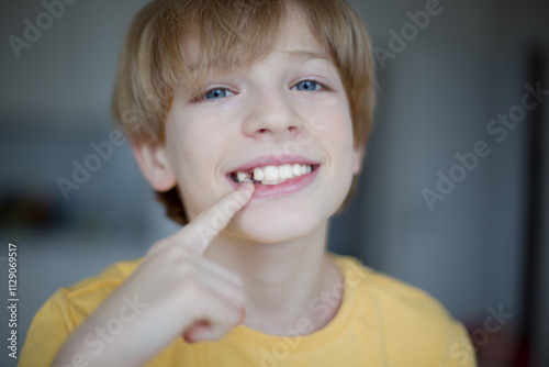 Teen Boy Showing Missing Tooth