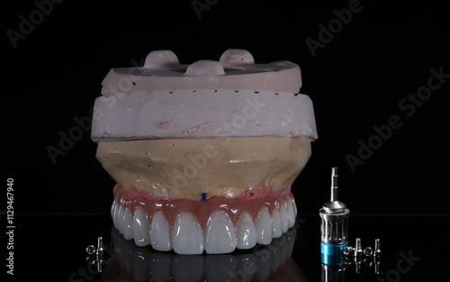 Full-arch porcelain implant-supported dental prosthesis for edentulous jaws with All-on-X and All-on-4 treatment procedure using dental implant surgery.