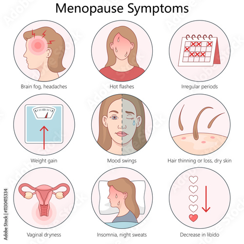 symptoms of menopause, including hot flashes, mood swings, insomnia, hair loss, and hormonal changes diagram hand drawn schematic vector illustration. Medical science educational illustration